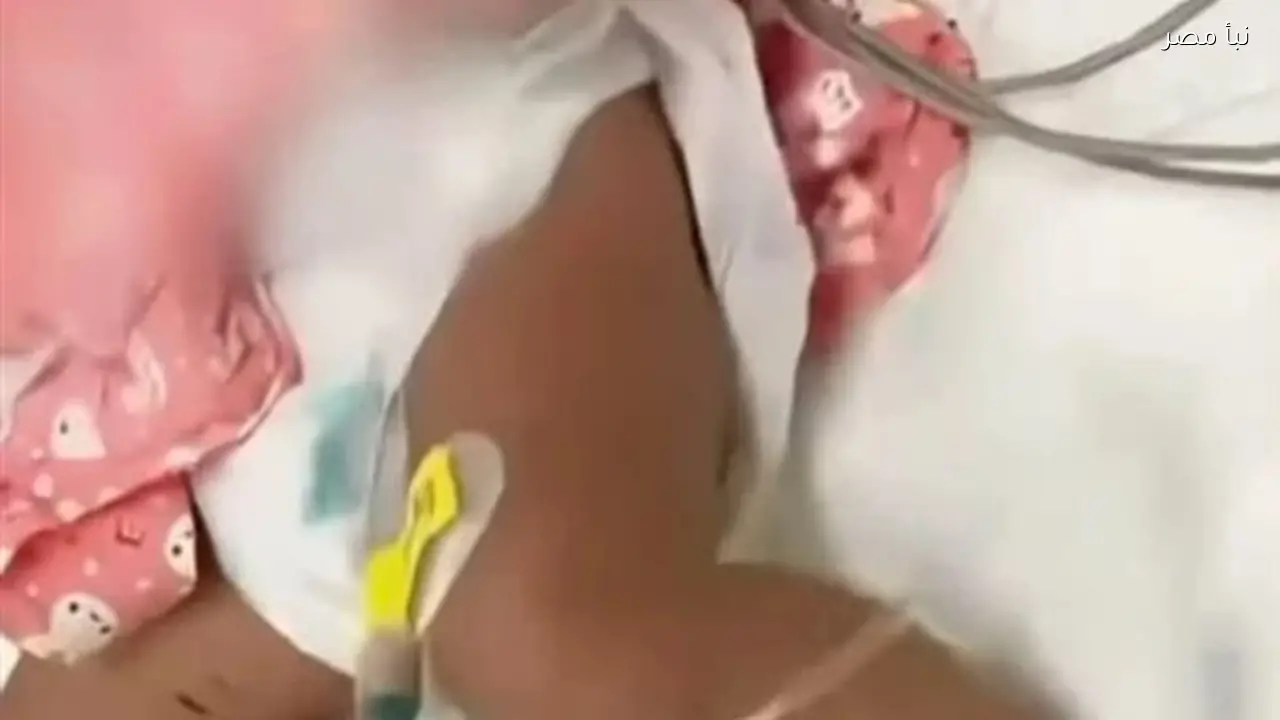 سيدة صينية تعالج رضيعها بطريقة خاطئة باستخدام الإبر مما أدى لنقله للمستشفى في حالة حرجة