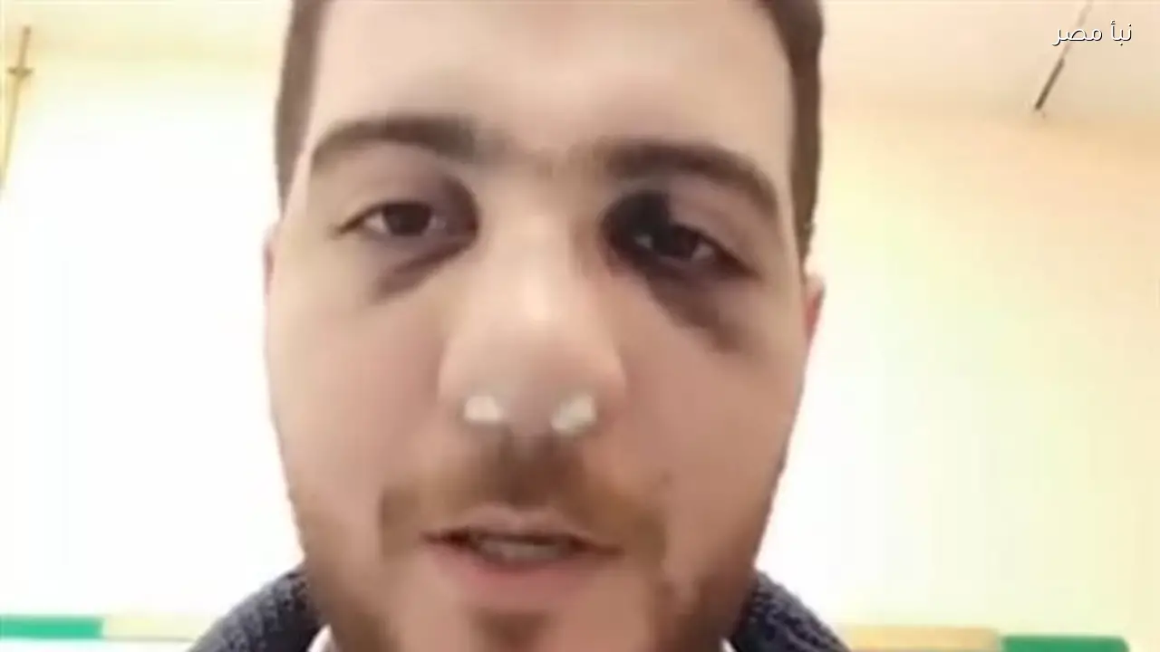 إخلاء سبيل طبيب عظام مستشفى الباجور بالمنوفية بكفالة عشرة آلاف جنيه بعد اتهامه بالتعدي على أسرة مريض