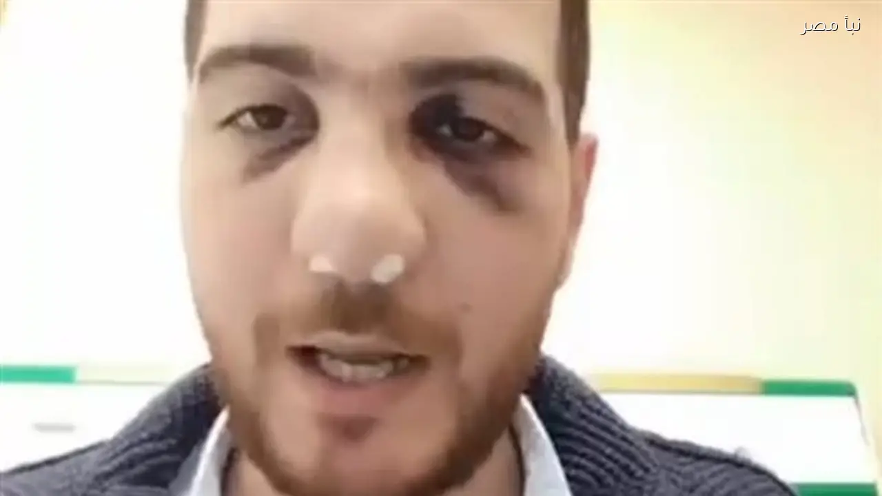 إصابة طبيب عظام بمستشفى الباجور بالمنوفية خلال مشاجرة مع مرافق مريضة