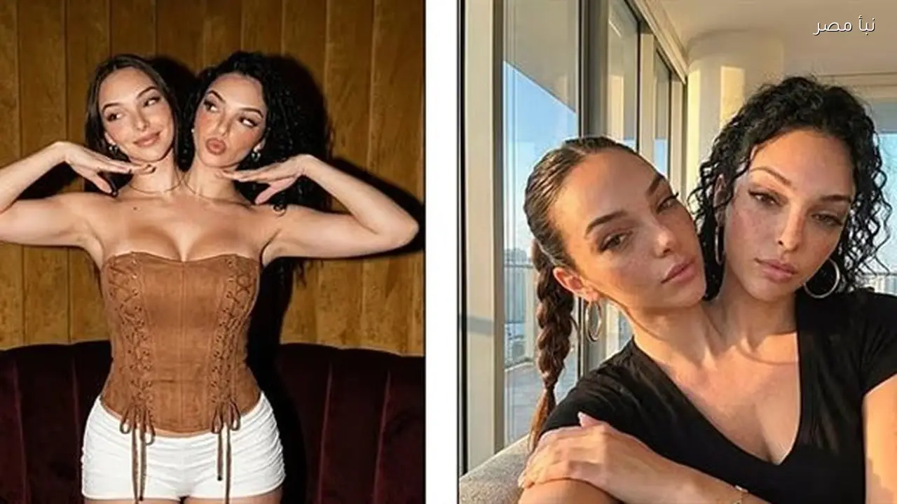 حقيقة قصة التوأم الملتصق فاليريا وكاميلا بعد تصدرهما قائمة الترند