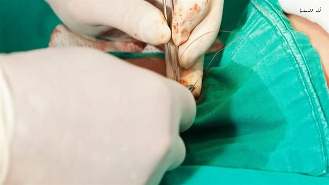 خلاف دبلوماسي بين بلجيكا وأمريكا بسبب أزمة ختان وثلاثة يهود في قلب القصة