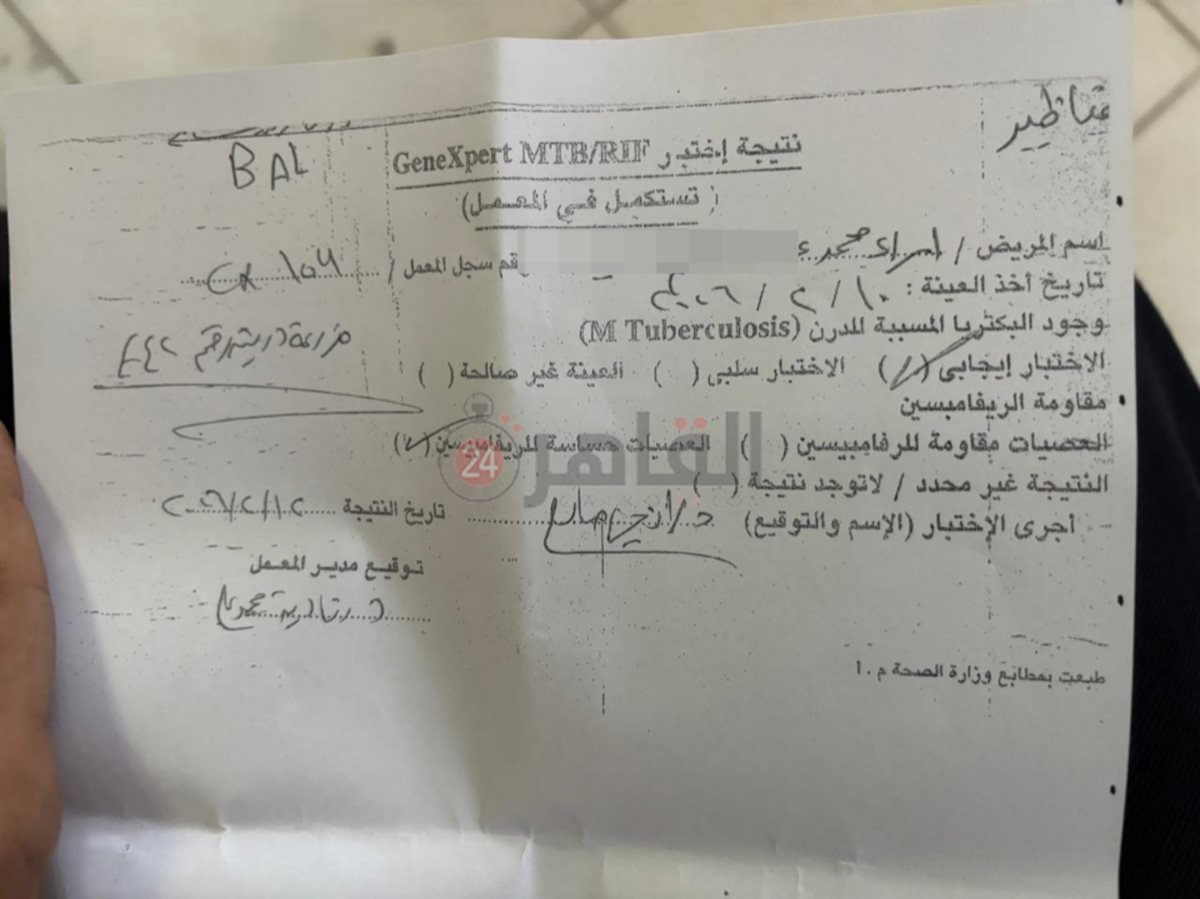 نتيجة التحليل الجيني