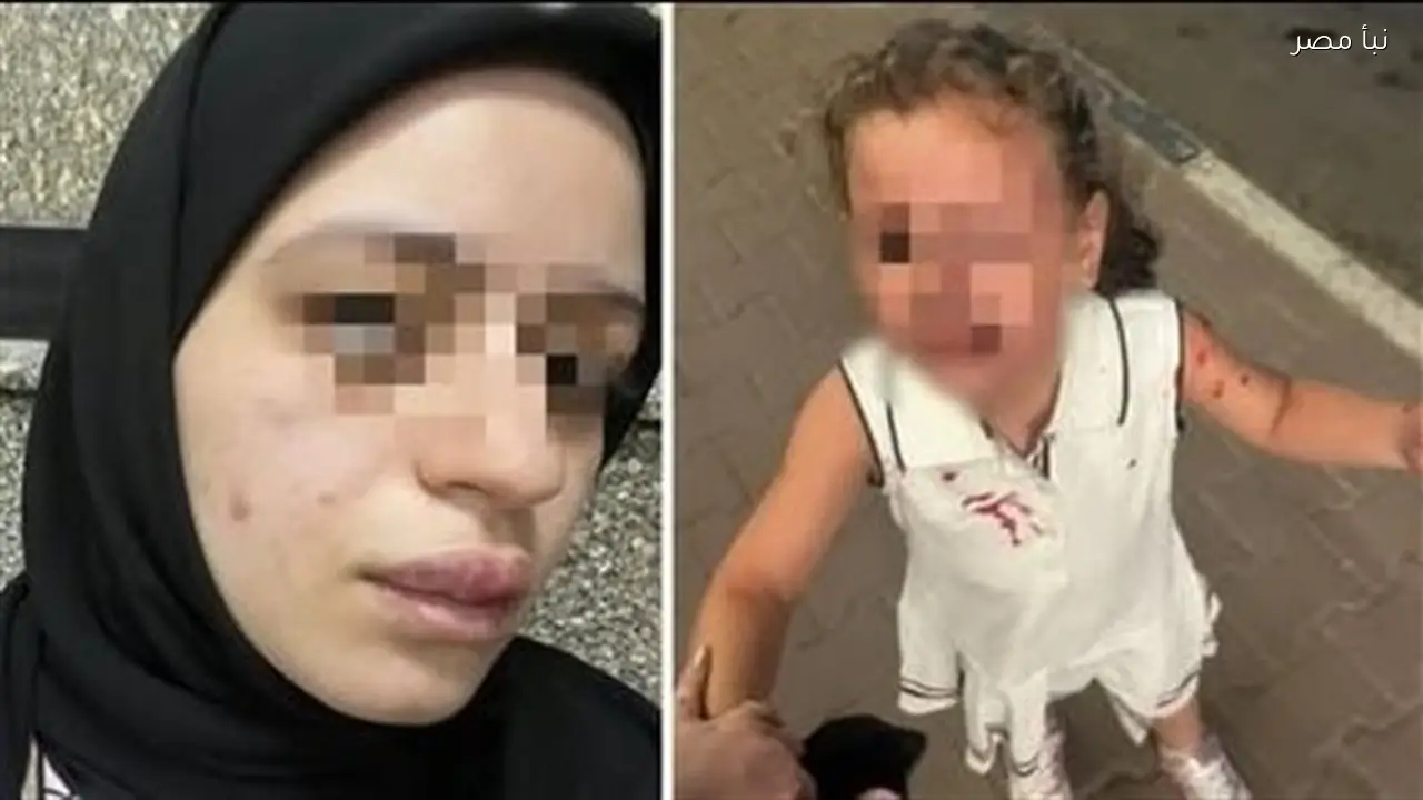 سيدة تستغيث بعد تعرضها للتهديد بالقتل والتشويه من طليقها الذي اعتدى عليها وعلى ابنتها