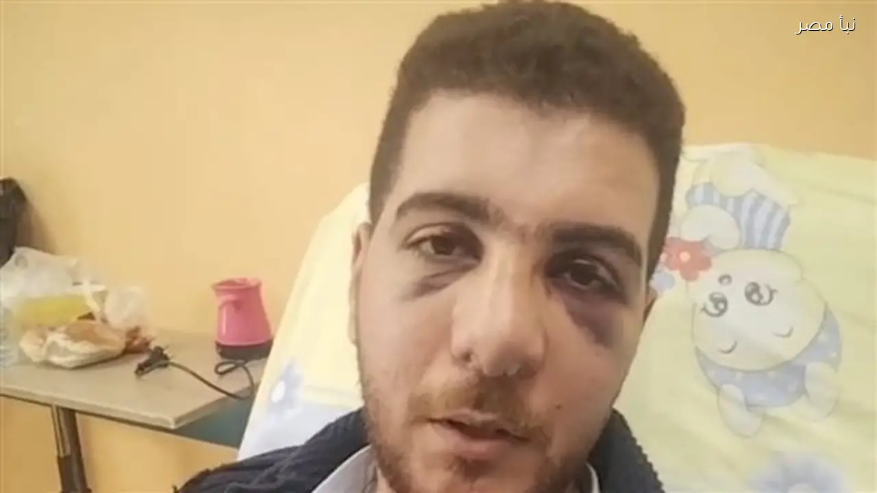 طبيب عظام بمستشفى الباجور يروي تفاصيل تعرضه لاعتداء من مرافق مريضة مما أدى إلى إصابته بكسور في الأنف