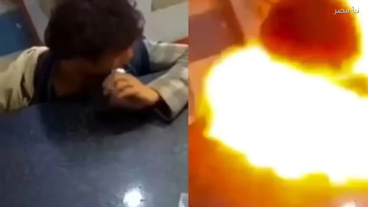 مراهق يتعرض لحروق خطيرة بعد قضم بطارية هاتف تنفجر في فمه