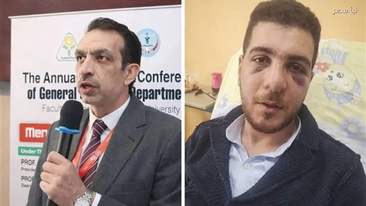 نقيب أطباء المنوفية يزور طبيب العظام المصاب في مشاجرة بمستشفى الباجور
